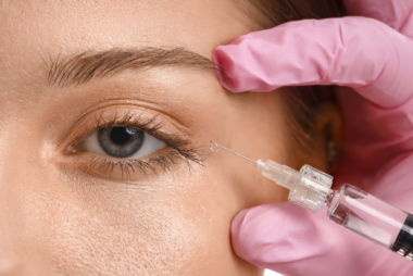 procedures for under eye wrinkles, cosmetic procedures for under eye wrinkles, eye bag surgery